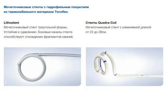 Мочеточниковые стенты