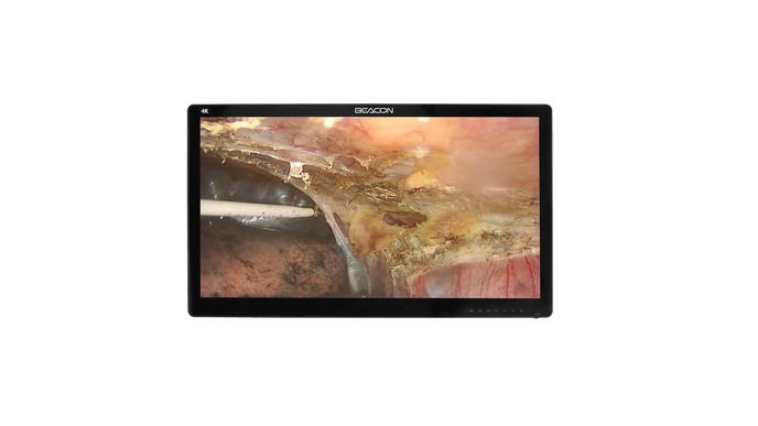 Хирургический монитор Beacon S5583P 55″ 4K